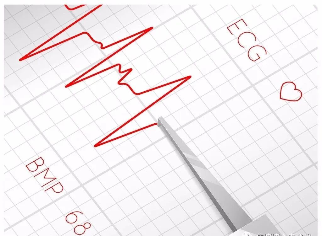 心电图纸的描述有哪些一文全解析 心电图到底该怎么看？_https://www.jmylbn.com_新闻资讯_第6张