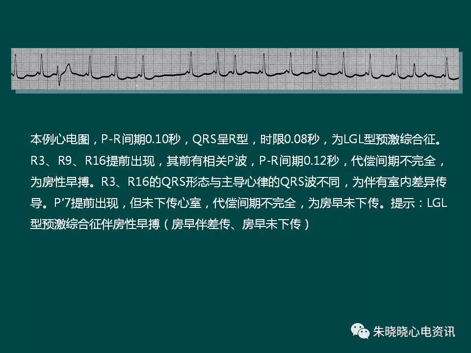 一文拿捏