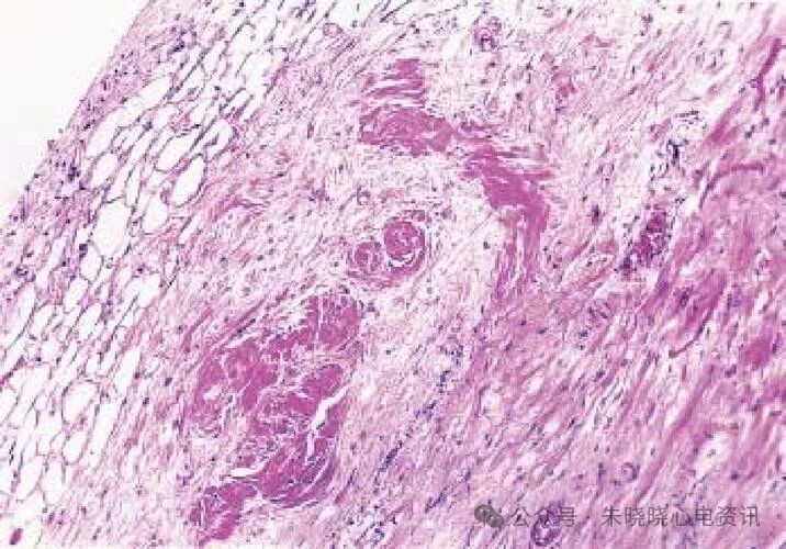 心率变异率怎么测olter（24小时）检测心率变异性指标的评价_https://www.jmylbn.com_新闻资讯_第8张