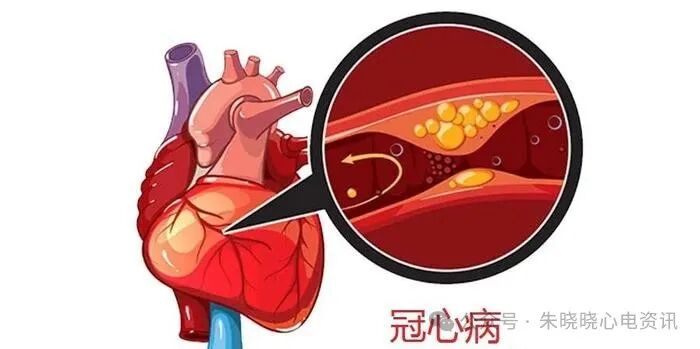 心率变异率怎么测olter（24小时）检测心率变异性指标的评价_https://www.jmylbn.com_新闻资讯_第4张