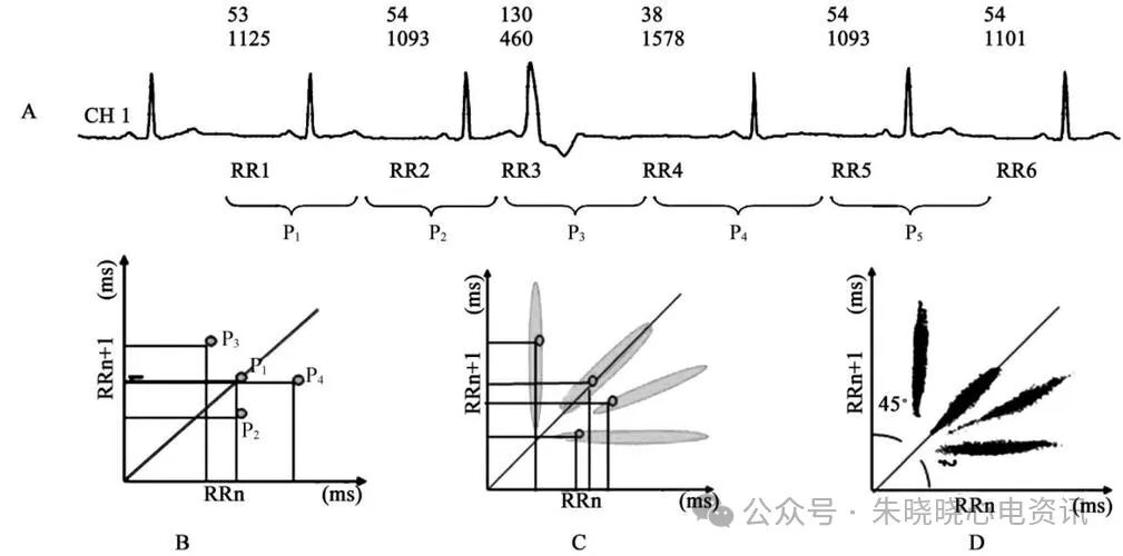 动态心电图怎么分析各种分析工具在动态心电图分析中的应用_https://www.jmylbn.com_新闻资讯_第5张