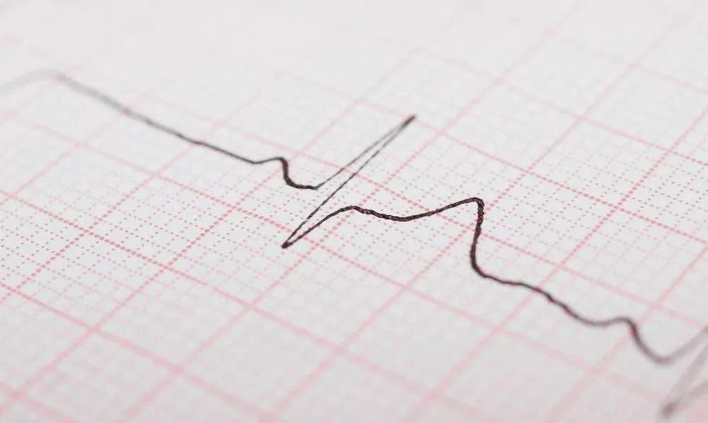 心电图病种简易诊断表，你收藏了吗？