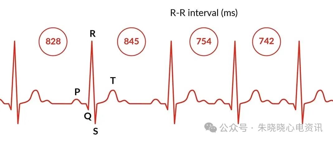 心率变异率怎么测olter（24小时）检测心率变异性指标的评价_https://www.jmylbn.com_新闻资讯_第3张