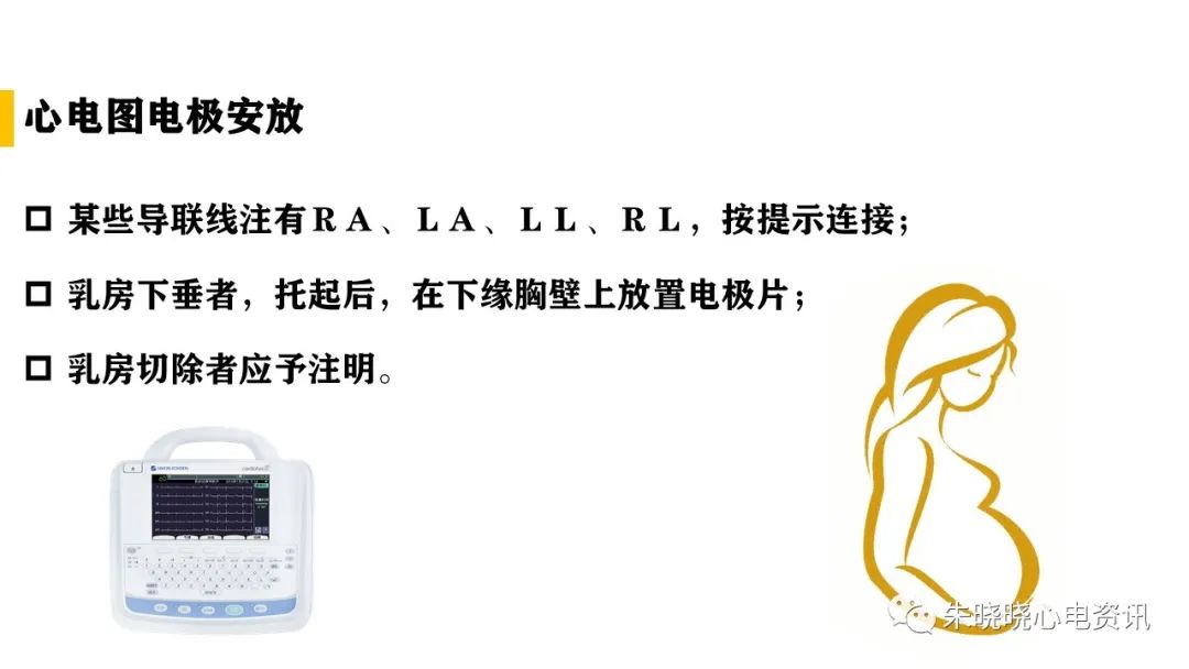 常规心电图检查操作指南（ppt版）