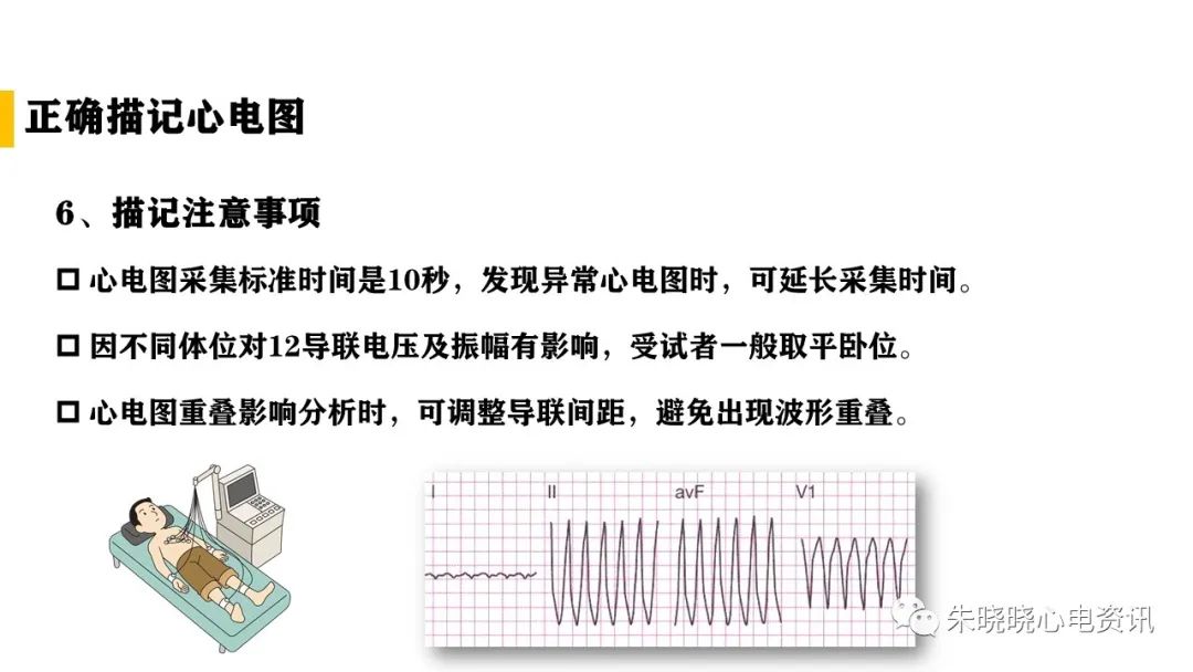 常规心电图检查操作指南（ppt版）