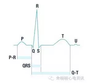 心电图纸的描述有哪些一文全解析 心电图到底该怎么看？_https://www.jmylbn.com_新闻资讯_第7张