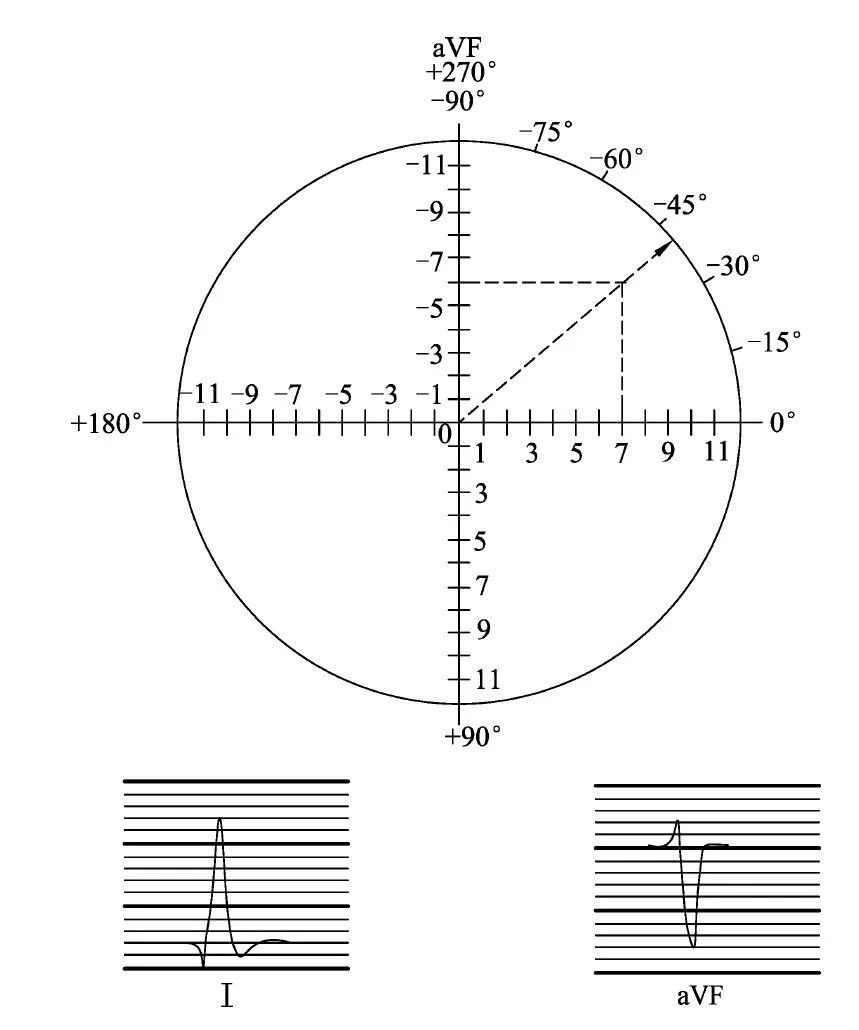 什么是同步心电图心电图测量技术指南_https://www.jmylbn.com_新闻资讯_第16张