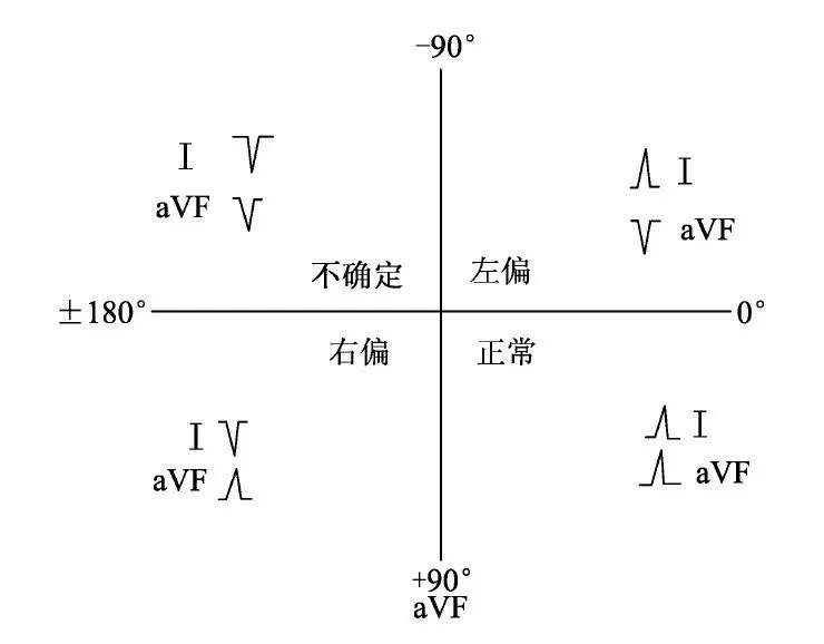 什么是同步心电图心电图测量技术指南_https://www.jmylbn.com_新闻资讯_第15张