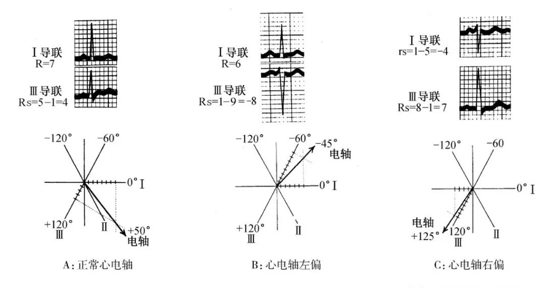 什么是同步心电图心电图测量技术指南_https://www.jmylbn.com_新闻资讯_第13张