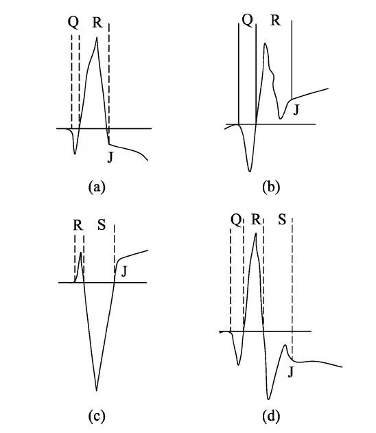 什么是同步心电图心电图测量技术指南_https://www.jmylbn.com_新闻资讯_第3张