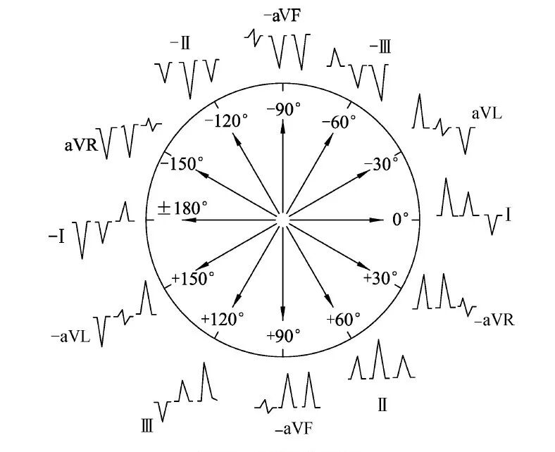 什么是同步心电图心电图测量技术指南_https://www.jmylbn.com_新闻资讯_第12张