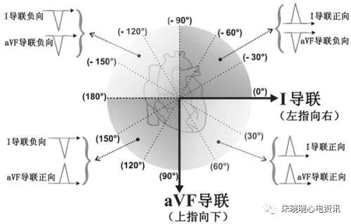 什么是同步心电图心电轴的测量方法，你掌握了几种？_https://www.jmylbn.com_新闻资讯_第10张