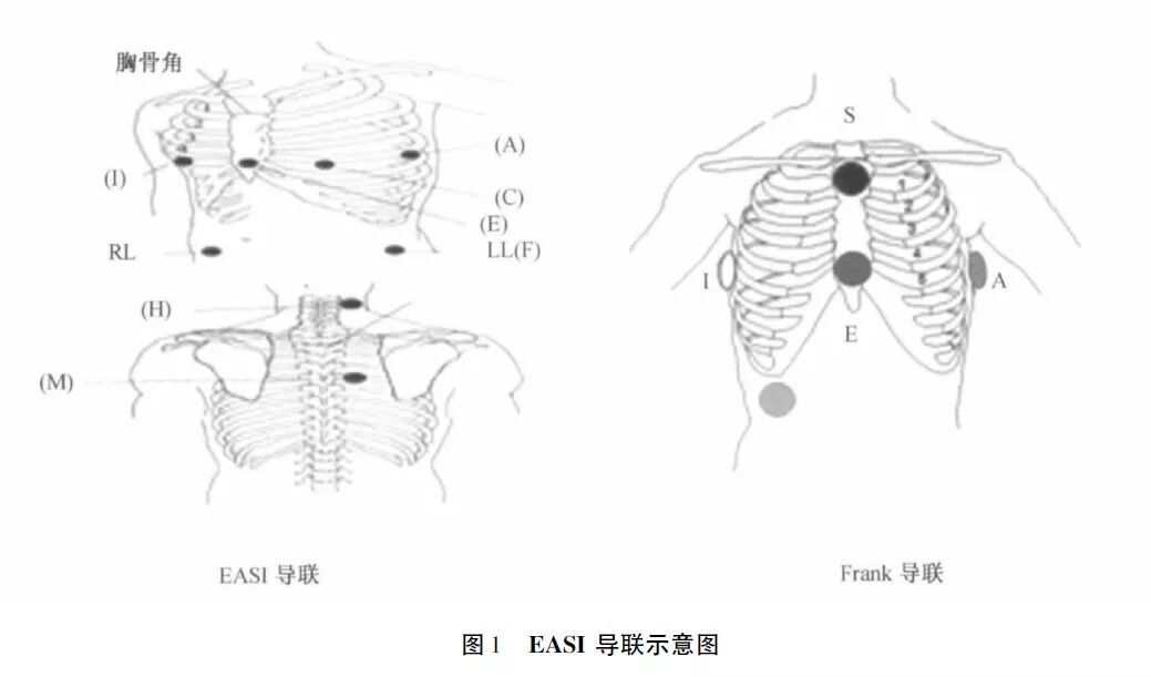 holter电极怎么贴动态心电图的规范化_https://www.jmylbn.com_新闻资讯_第8张