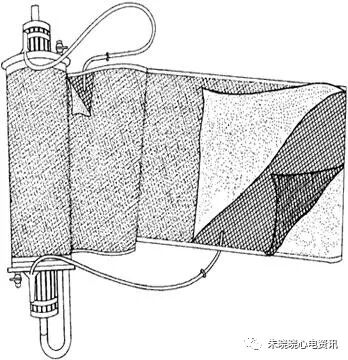什么是气体陷闭ECMO的裝置与准备_https://www.jmylbn.com_新闻资讯_第11张