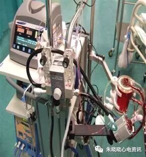 什么是气体陷闭ECMO的裝置与准备_https://www.jmylbn.com_新闻资讯_第8张