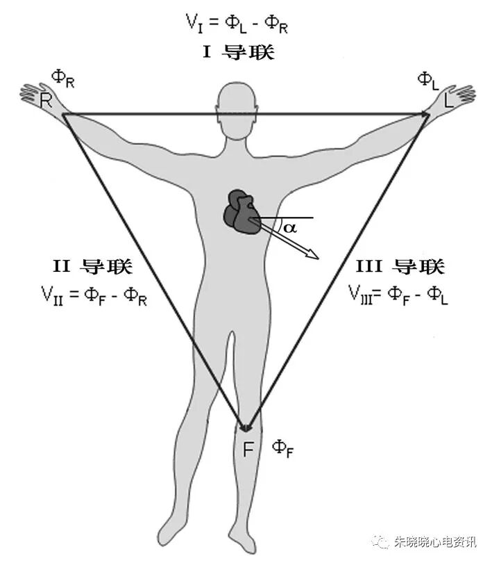 心电图怎么切换导联临床实用心电图入门系列之二：心电图导联、波形及临床价值_https://www.jmylbn.com_新闻资讯_第6张