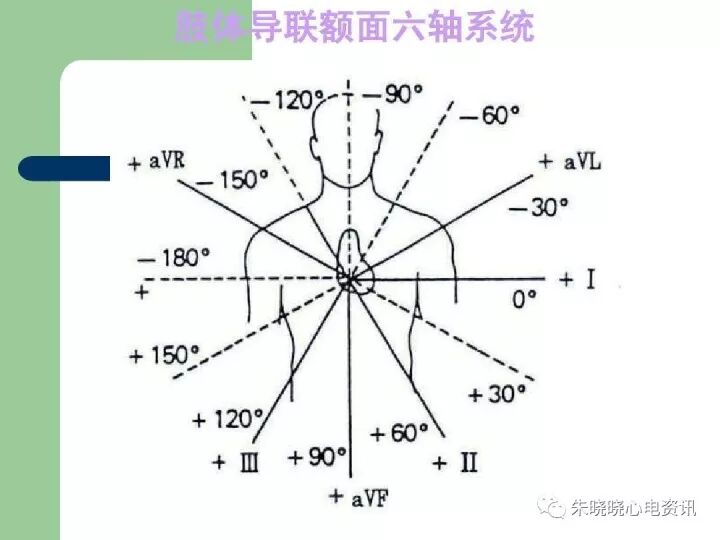 六导心电图怎么用景永明老师：心电图aVR导联在额面六轴系统中的地位与作用_https://www.jmylbn.com_新闻资讯_第2张