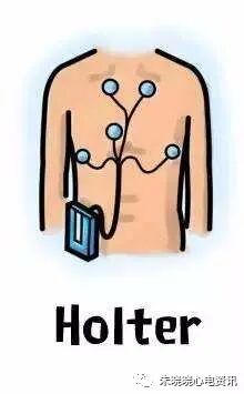 动态心电图怎么分析各种分析工具在动态心电图分析中的应用_https://www.jmylbn.com_新闻资讯_第2张
