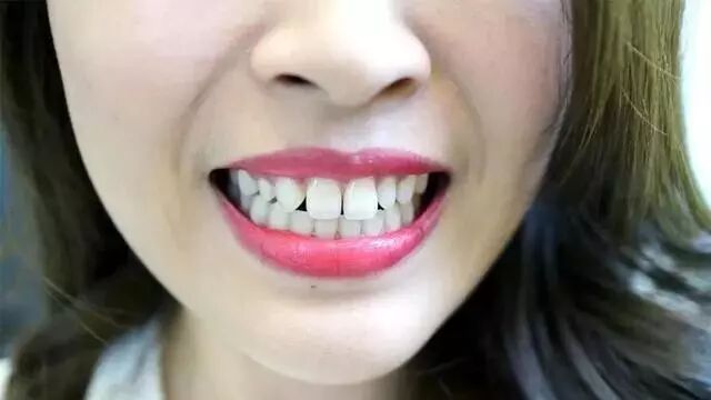 这些美白牙齿的方法，你用过吗？