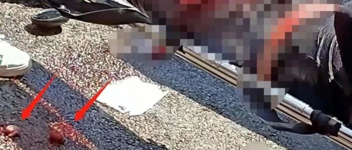 “我救的人，内出血严重，睾丸两颗都在地上，能活就是奇迹”