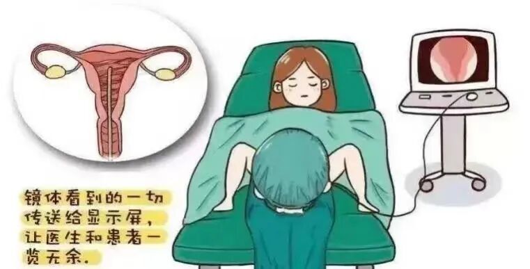 宫内镜怎么进入子宫我院妇科成功开展阴道内镜检查+经阴道内镜子宫内膜息肉切除术_https://www.jmylbn.com_新闻资讯_第5张