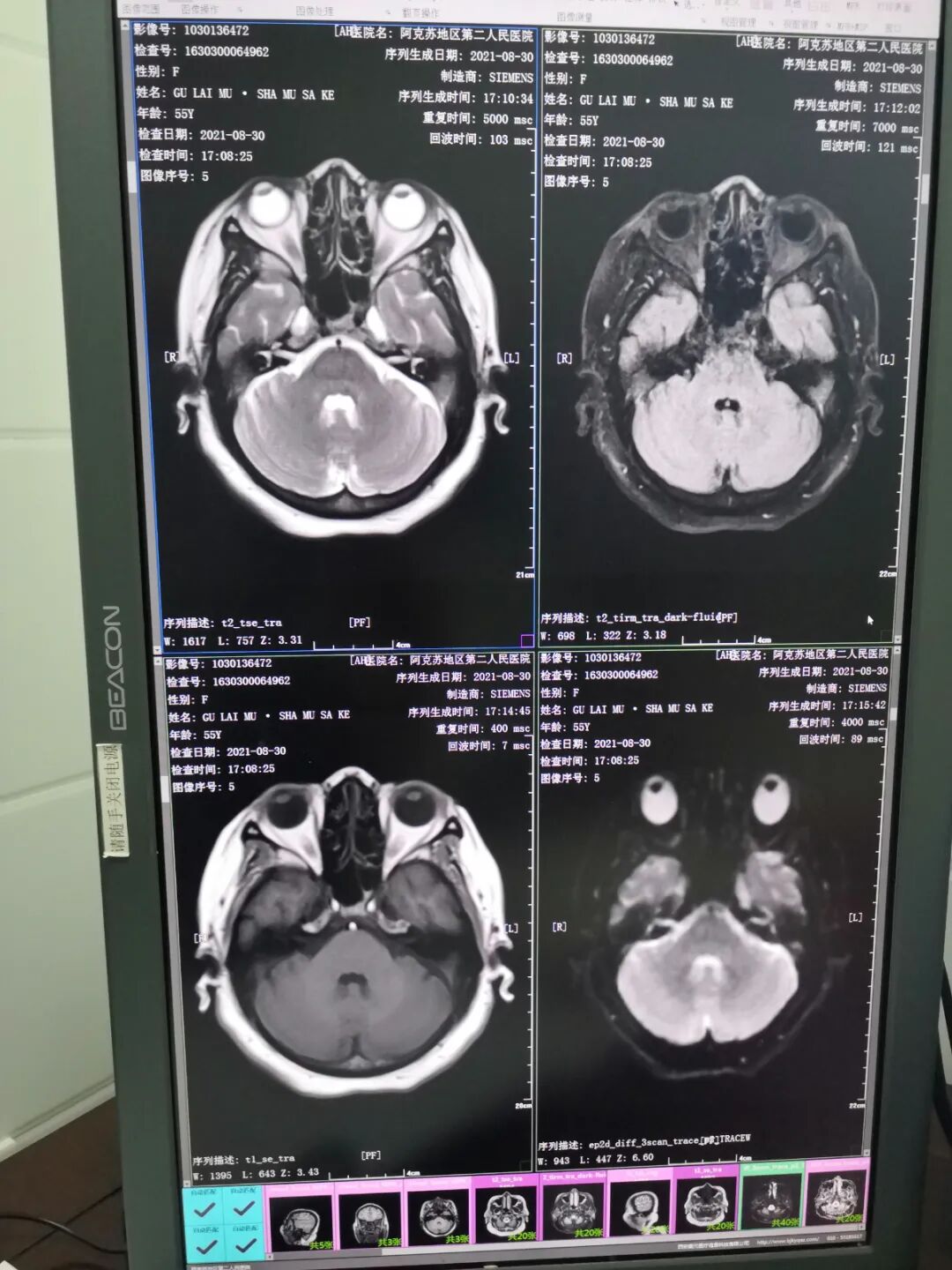 拍胃肠机怎么收费拍一次CT辐射有多大？会致癌吗？走进放射科一起了解_https://www.jmylbn.com_新闻资讯_第8张