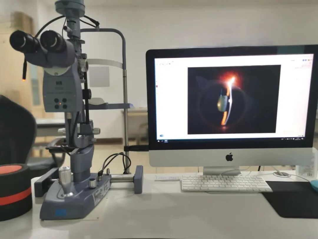 眼科有哪些设备眼科医生的好帮手——眼科检查设备有哪些_https://www.jmylbn.com_新闻资讯_第3张