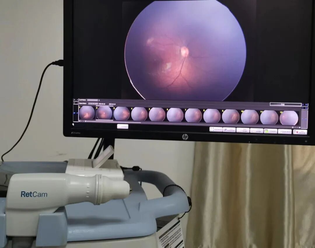 眼科有哪些设备眼科医生的好帮手——眼科检查设备有哪些_https://www.jmylbn.com_新闻资讯_第9张