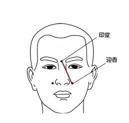 雷火灸的成分是什么【金医科普】一缕雷火暖经络，半盏艾香护鼻安——雷火灸守护呼吸舒适感_https://www.jmylbn.com_新闻资讯_第14张