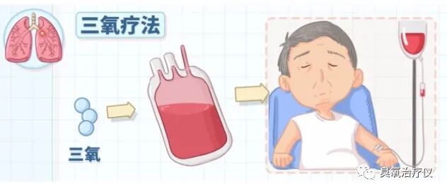 医用三氧是什么医用三氧的5大医用功能_https://www.jmylbn.com_新闻资讯_第1张