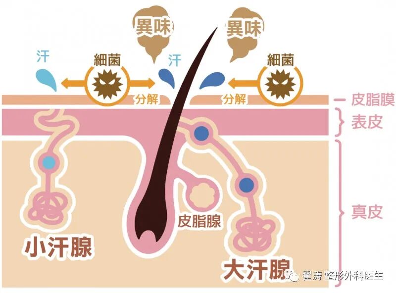 狐臭如何彻底去掉？