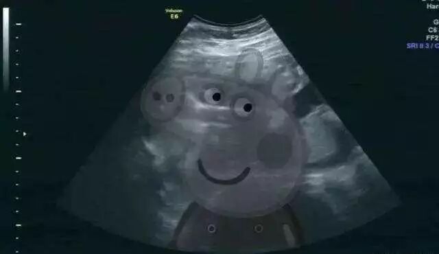 遇生育高峰，“坐月子”的这些事儿你得早知道！