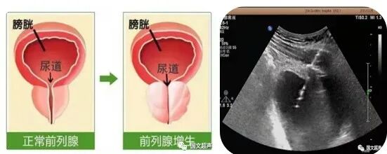 logiq e怎么读超声影像 ｜ 国文医院引进GE LOGIQ E11全“芯”高端全身超声_https://www.jmylbn.com_新闻资讯_第16张