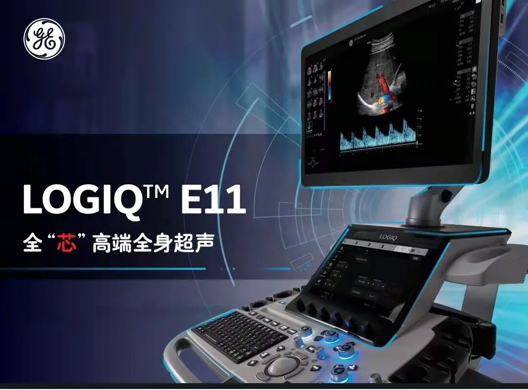 logiq e怎么读超声影像 ｜ 国文医院引进GE LOGIQ E11全“芯”高端全身超声_https://www.jmylbn.com_新闻资讯_第23张