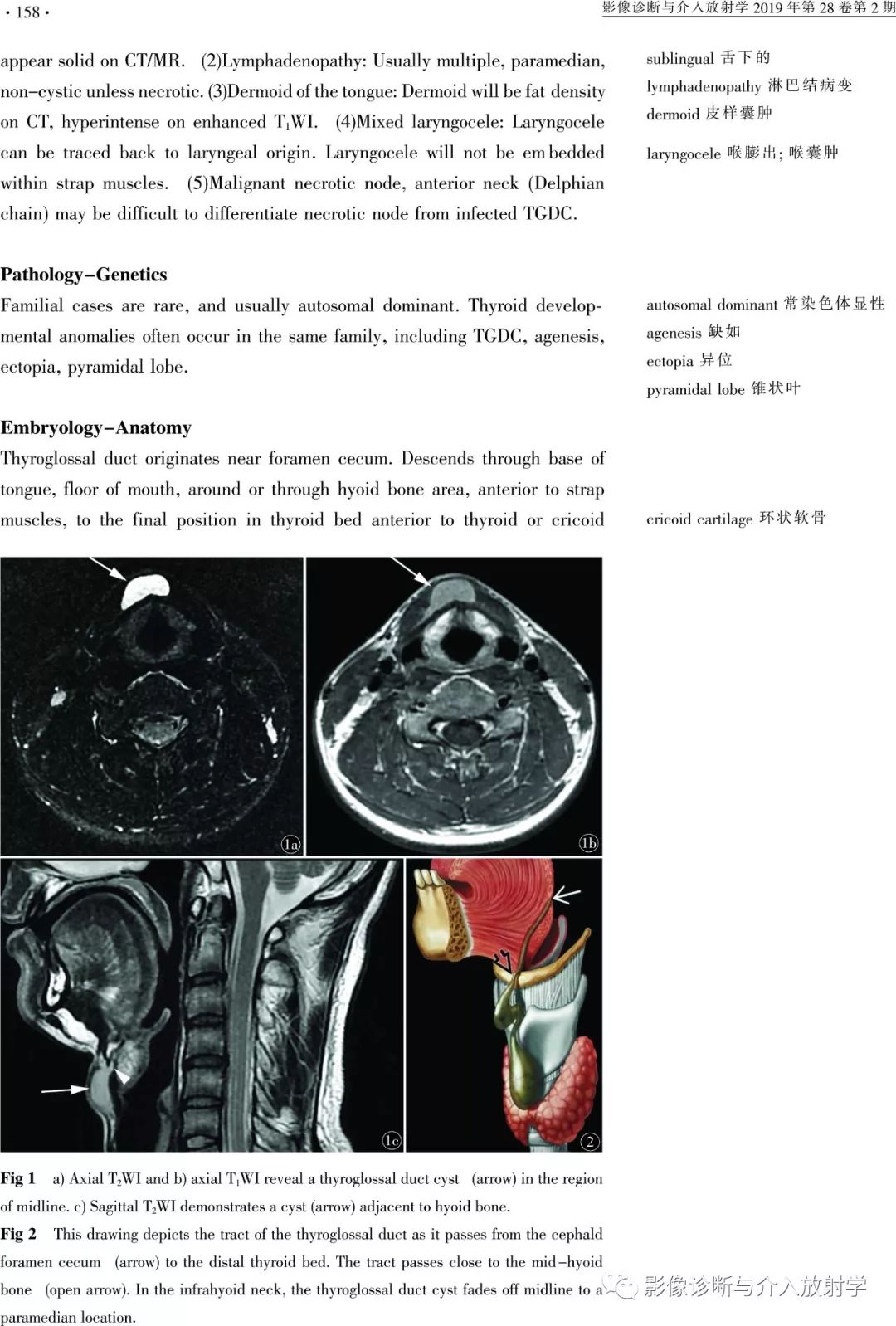 影像医学英语阅读 Thyroglossal Duct Cyst 甲状舌管囊肿 影像诊断与介入放射学 微信公众号文章阅读 Wemp