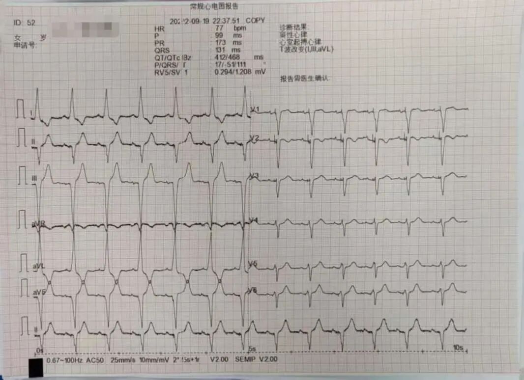 手术电极是什么意思超声引导，东莞市人民医院心内科团队“零射线”植入心系列双腔起搏器_https://www.jmylbn.com_新闻资讯_第7张