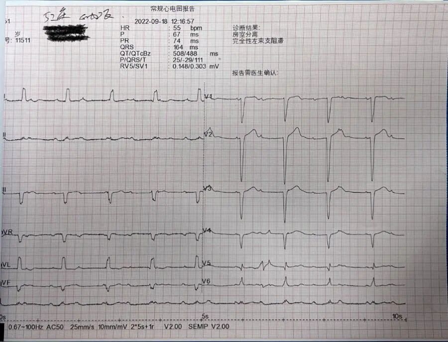 手术电极是什么意思超声引导，东莞市人民医院心内科团队“零射线”植入心系列双腔起搏器_https://www.jmylbn.com_新闻资讯_第2张