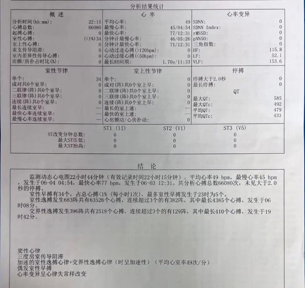 手术电极是什么意思超声引导，东莞市人民医院心内科团队“零射线”植入心系列双腔起搏器_https://www.jmylbn.com_新闻资讯_第1张