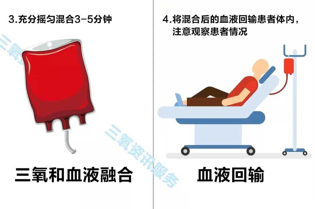 什么是臭氧大自血疗法【新技术】用自己的血救自己，我院针推科开展治疗新技术“臭氧大自血回输治疗术”_https://www.jmylbn.com_新闻资讯_第5张