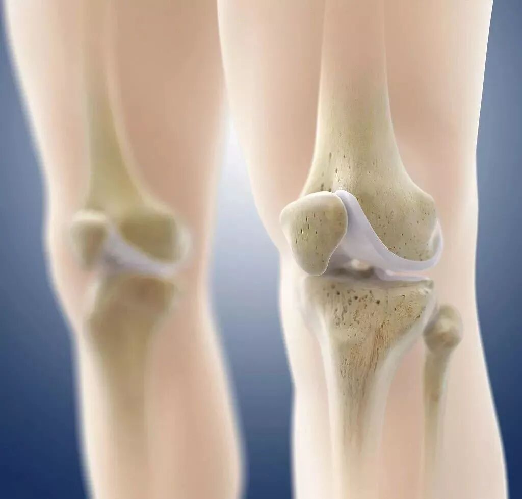 膝关节软骨退化的信号