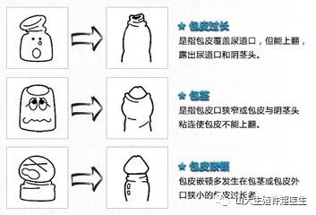 宝宝包皮过长 要去切吗 健康与预防 微信公众号文章阅读 Wemp