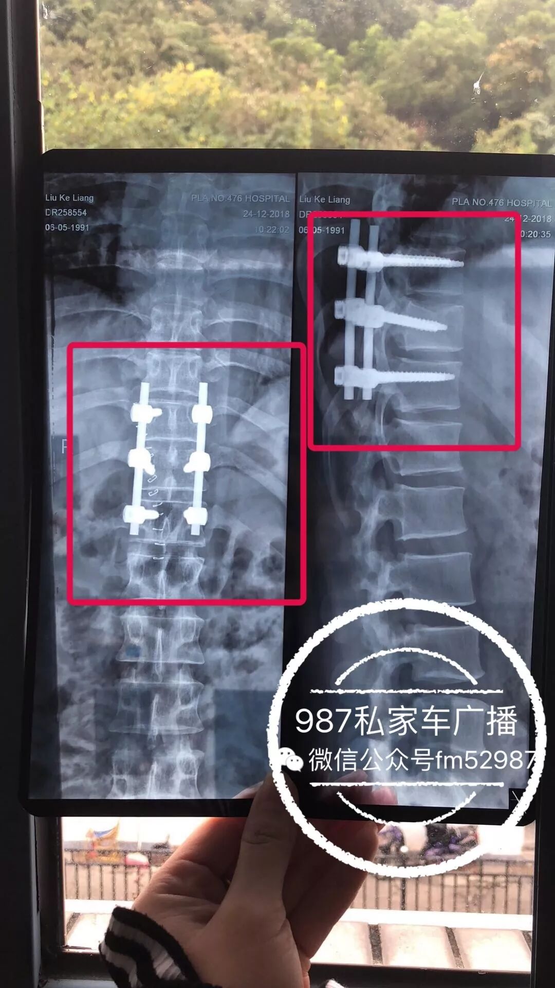 驚悚！福州一司機被顧客一腳踹下旗山！上演生死大逃亡...... 靈異 第8張