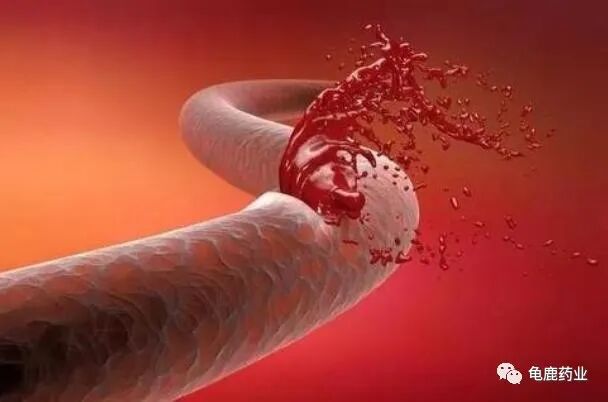 原来这才是人体最容易衰老的地方，如何才能延缓衰老？