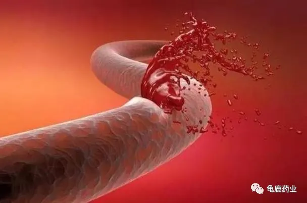 原来这才是人体最容易衰老的地方,如何才能延缓衰老? 原来这才是人体最容易衰老的地方,如何才能延缓衰老?