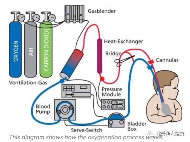 CNIW joints BMDAC and other organizations donating ECMOs-Centre for New Immigrant Well-Being (CNIW)