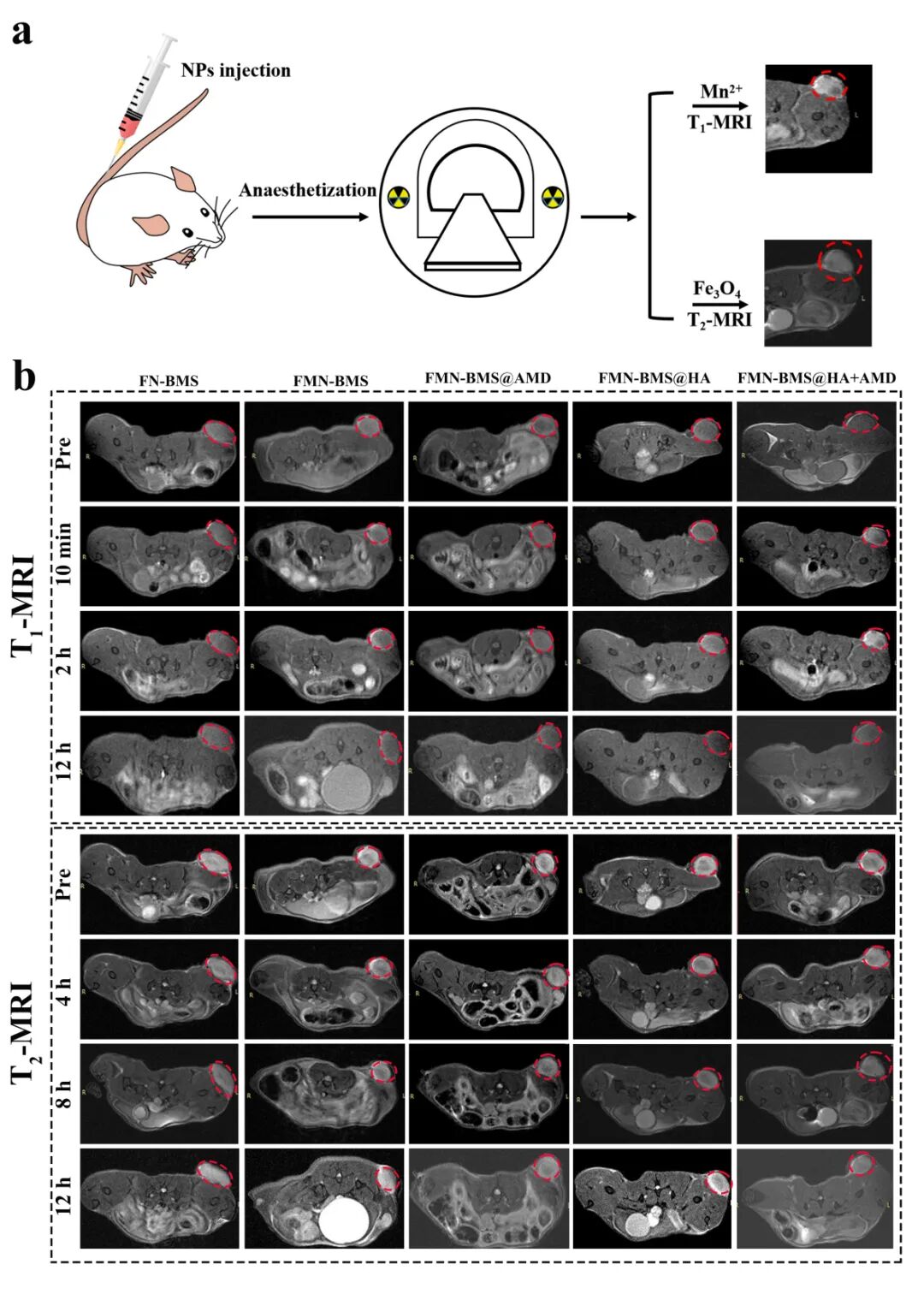 Nanotoday：多功能纳米平台实现影像指导化学动力治疗-CXCR4拮抗-PD-L1阻断协同治疗乳腺癌
