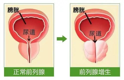 这个器官，会随着年龄的增长而变大！