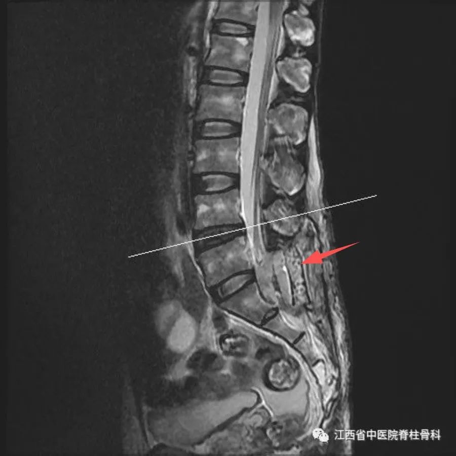 大小便障礙，會陰部不適，這是因為...... 健康 第11張