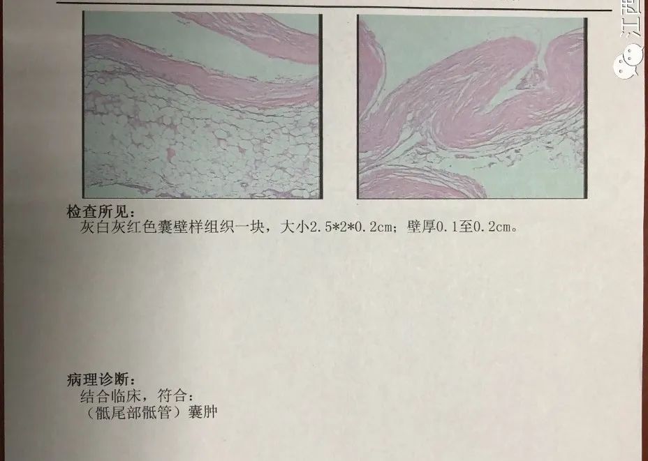 大小便障礙，會陰部不適，這是因為...... 健康 第12張