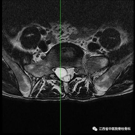 大小便障礙，會陰部不適，這是因為...... 健康 第6張